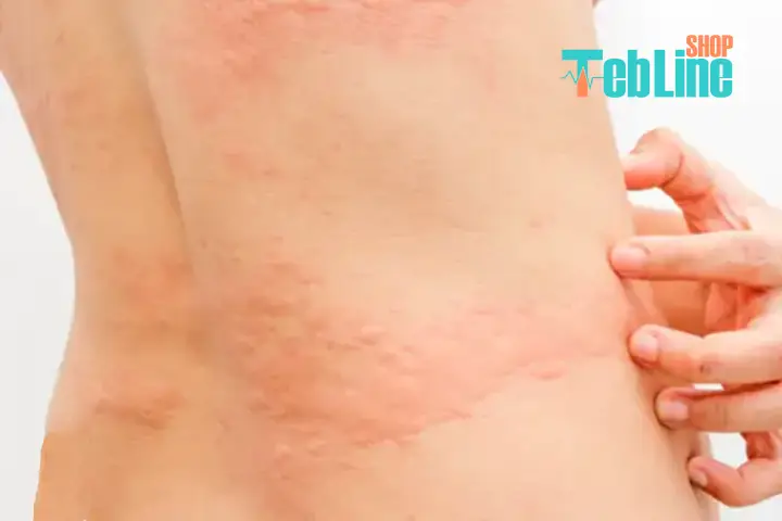 عوارض استفاده از مکمل گلوکزامین کندرویتین