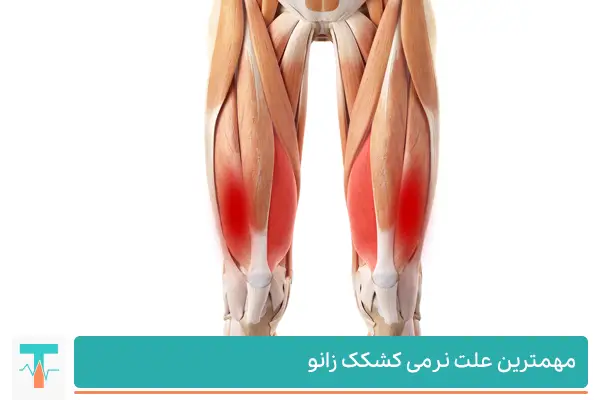 صدمه به زانو، استفاده بیش از حد از زانو و عدم قرارگیری صحیح ماهیچه ها و استخوان های اطراف زانو است.
