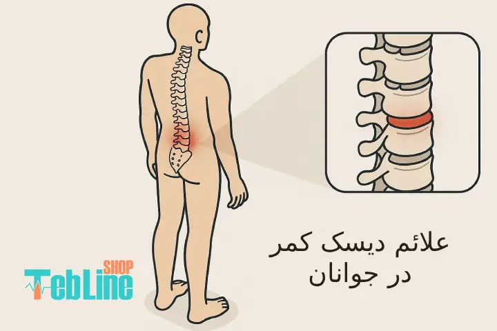 علائم دیسک کمر در جوانان