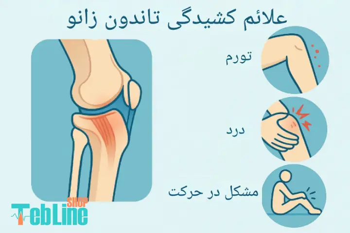علائم کشیدگی تاندون زانو