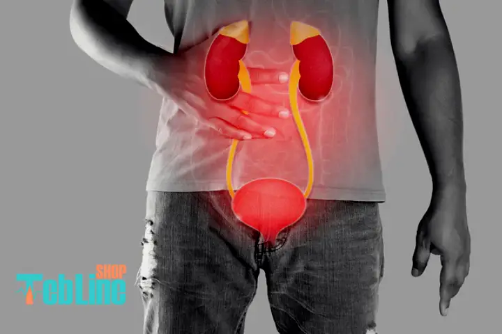 علت تکرر ادرار و کمردرد در مردان