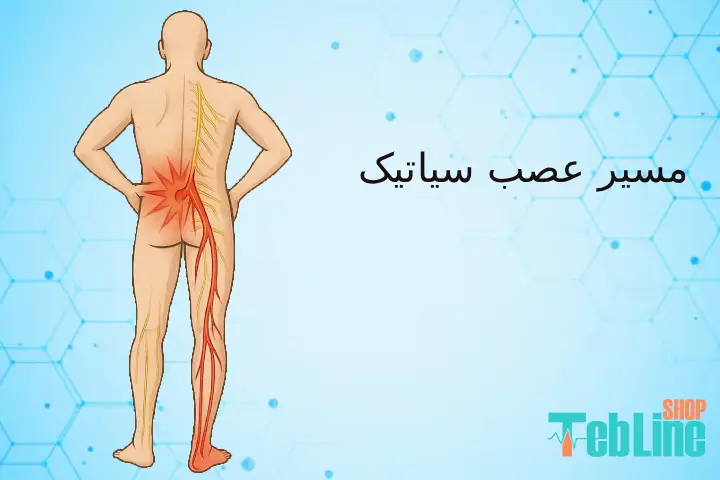 مسیر عصب سیاتیک