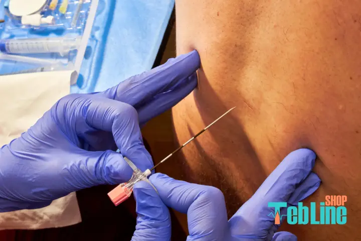 تزریق برای تنگی کانال نخاعی