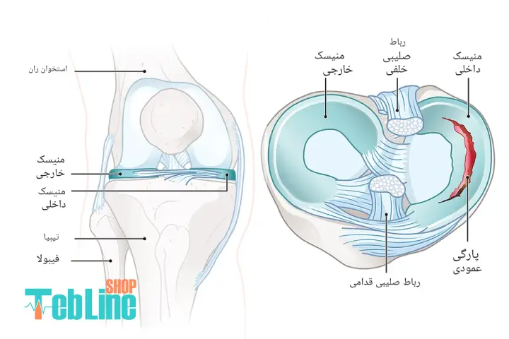 مینیسک زانو چیست
